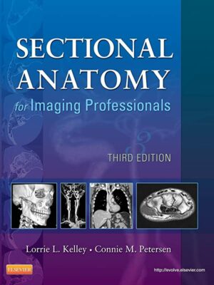 Test Bank For Sectional Anatomy For Imaging Professionals